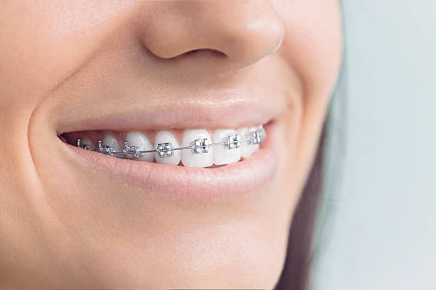 Best Dental Inlays and Onlays  in Mango, FL